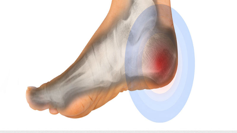 Treat Your Ankles Right with Ankle Specialists in Racine, WI