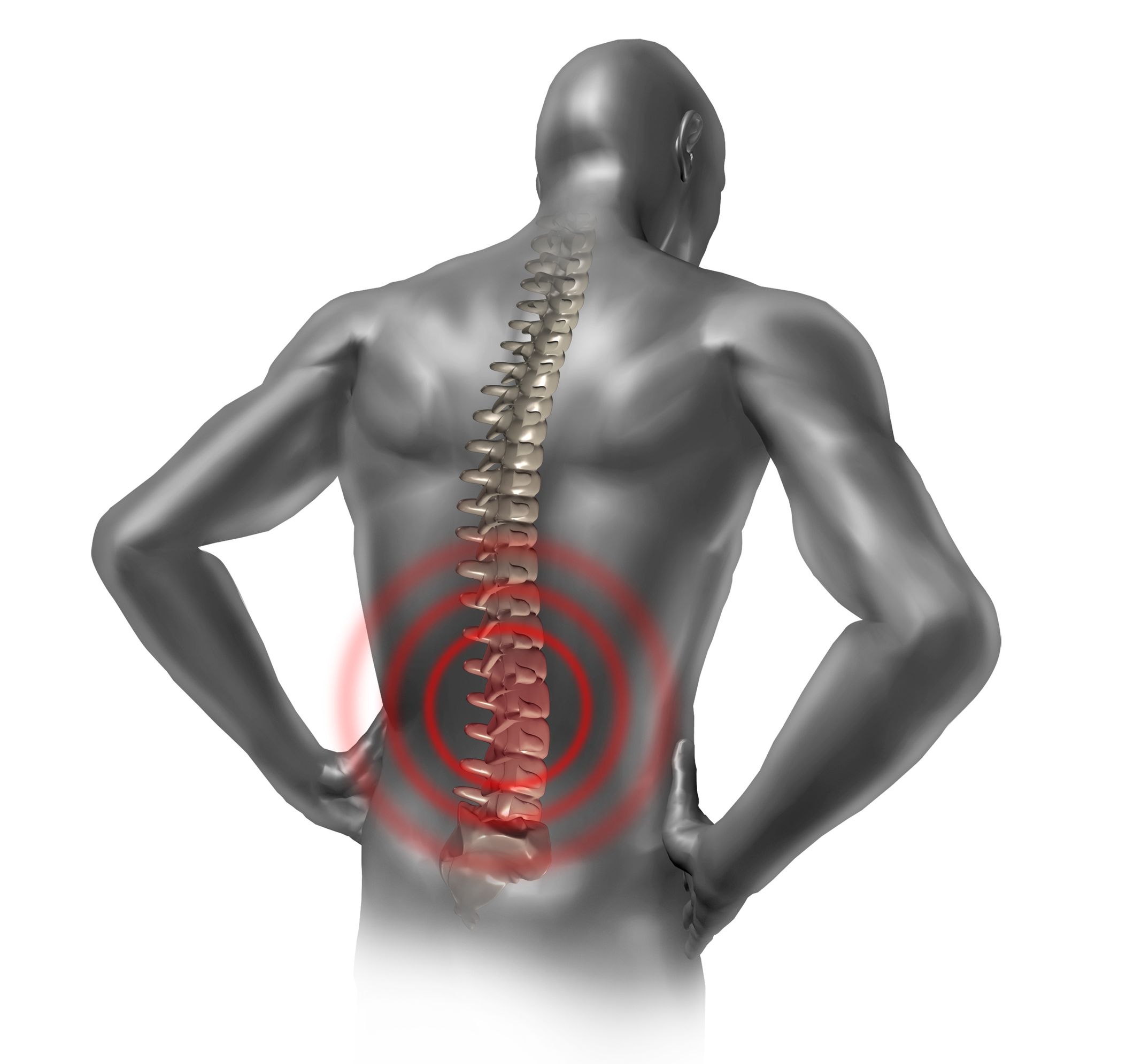 How Orthopedic Doctors in Panama City, FL Treat Back Pain with Epidural Injections