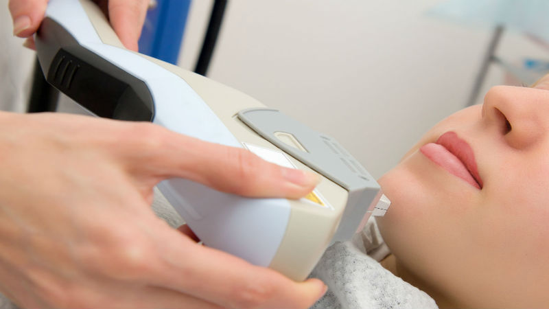 What to Know Before Getting Laser Hair Removal in Fayetteville