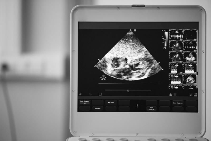 Using a Company Offering a Used Ultrasound Machine for Sale Is Best