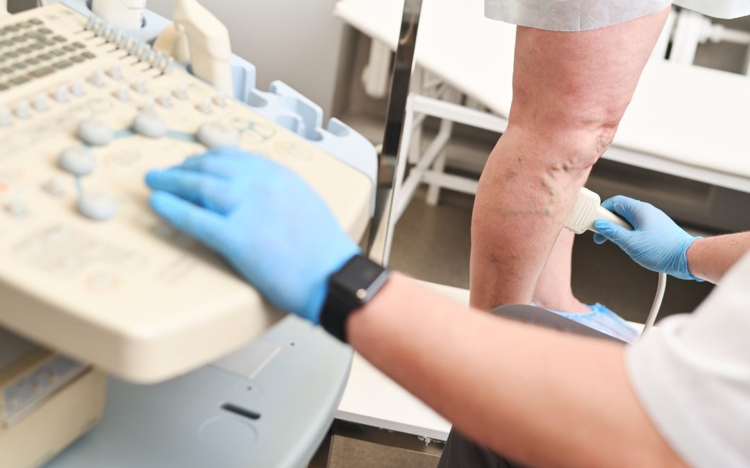 Your Varicose Veins Can Be Eliminated With Sclerotherapy in Schaumburg