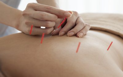 Pain Relief Solutions With a Local Acupuncturist Union City, CA Residents Trust