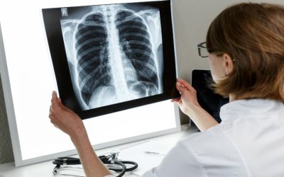 Wake Refreshed Using Sleep Apnea Treatment Menifee, CA for Lasting Relief