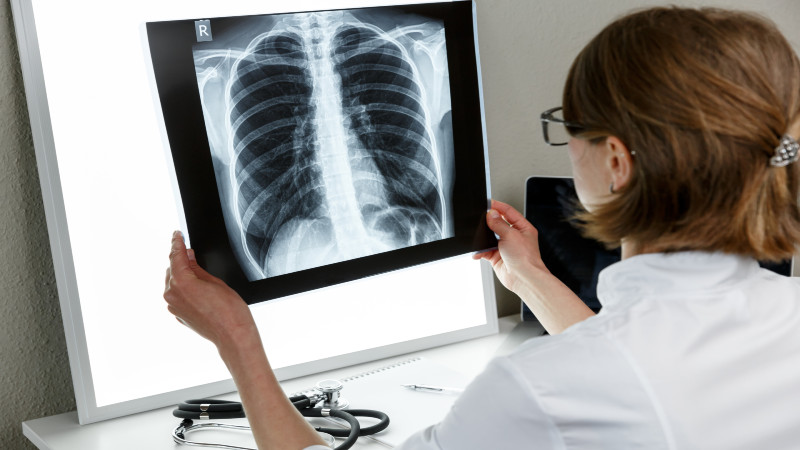 Wake Refreshed Using Sleep Apnea Treatment Menifee, CA for Lasting Relief